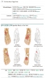 한 손에 잡히는 트리거포인트