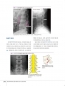 일차진료의를 위한 근골격 질환의 단순 X선 영상 판독법움직임의 기능 해부학