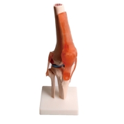무릎 관절 모형