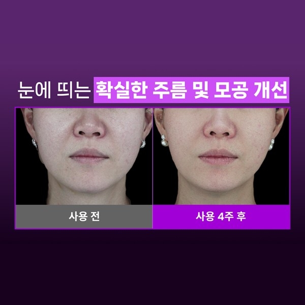 SHAL샬 28일 콜라겐복원프로그램