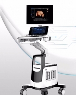 Cbit8vet 초음파기