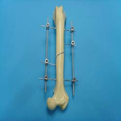 vumex external fixation-staight rod(Large)