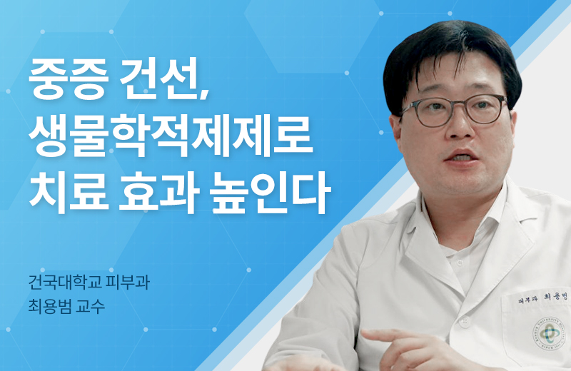 이전글