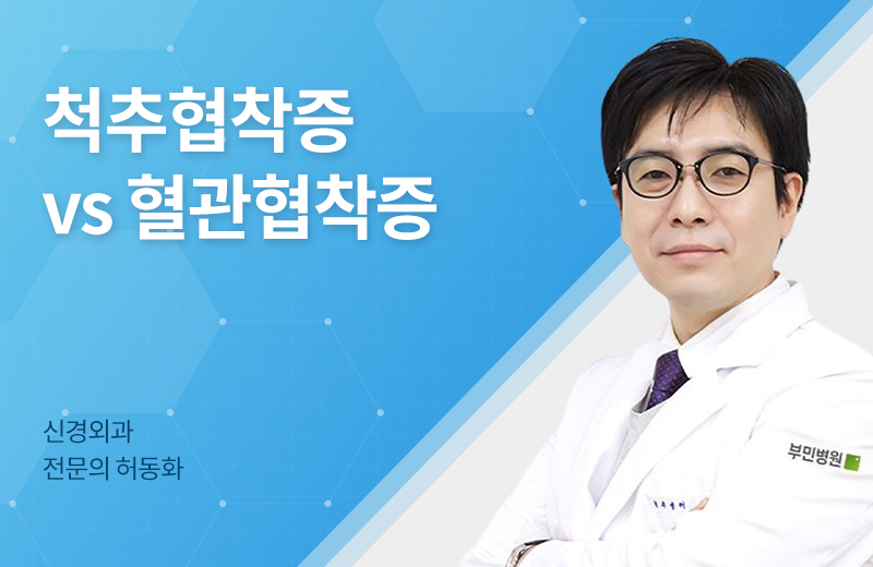 메디컬_협착증(1045187).jpg^|^메디컬_협착증(1045187)_660x405.jpg^|^메디컬_협착증(1045187)_카카오공유.jpg