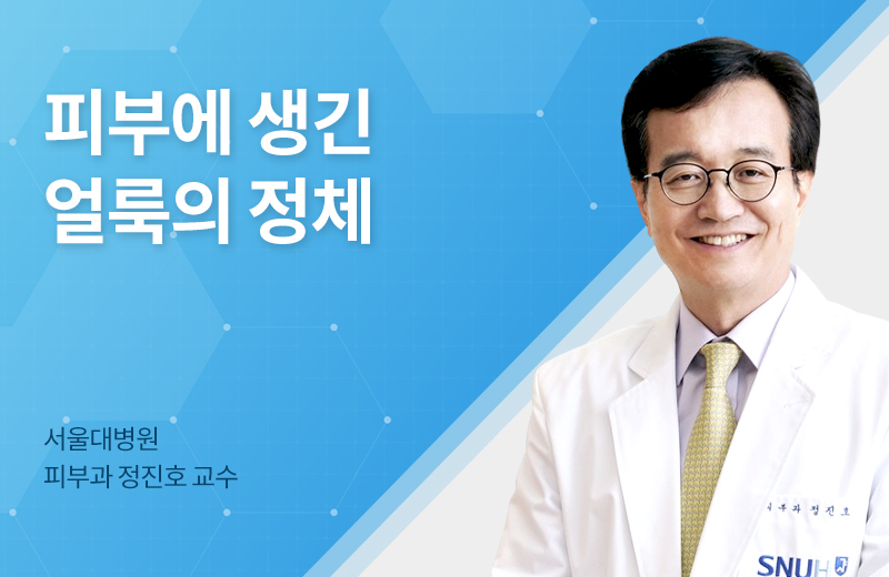 메디컬_반상피부경화증(1067649).jpg^|^메디컬_반상피부경화증(1067649).jpg^|^메디컬_반상피부경화증(1067649)_카카오공유.jpg