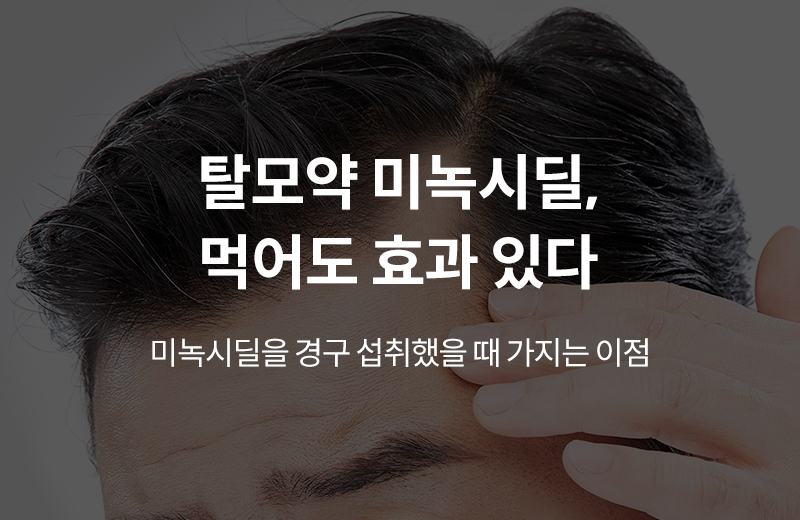 알쓸건강_썸네일-87.jpg^|^알쓸_미녹시딜(1018352)_660x405.jpg^|^카카오공유하기_알쓸건강_85.jpg
