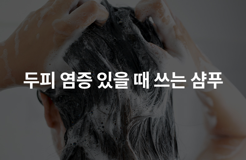 알쓸_두피샴푸(1084458).jpg^|^알쓸_두피샴푸(1084458)_660x405.jpg^|^알쓸_두피샴푸(1084458)-카카오공유.jpg