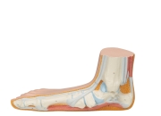 3B 인체모형 평발 M31 발모형 평발모형 Flat Foot (Pes Planus) Model