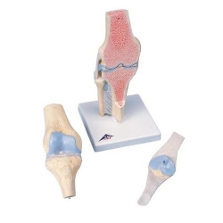 3B 인체모형 무릎관절단면모형 A89 3파트분리 무릎관절모형