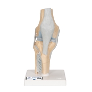 3B 인체모형 무릎관절 단면모형 A89 3파트분리 무릎관절모형 Sectional Knee Joint Model 3 part