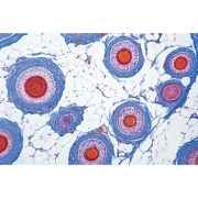 3B 인체모형 현미경 슬라이드 인간 두피와 모발 W13443 두피현미경슬라이드 모발현미경슬라이드