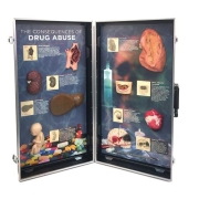 3B 인체모형 약물남용의결과 W43054 3D게시판 약물남용으로 인한 질병 Consequences of Drug Abuse, 3D Info Board