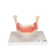 3B 인체모형 치아질환모형 D26 [21파트] 치아관리 치과모형 이빨모형 치아구조모형 2배확대 Dental disease magnified