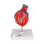3B 인체모형 관상동맥 우회술 심장모형 G05 (2파트) 심장모델 Classic Human Heart Model with Bypass, 2 part