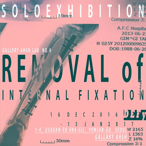 gallery aHsh LAB No.4 - 김기태(Def) Removal of Internal Fixation